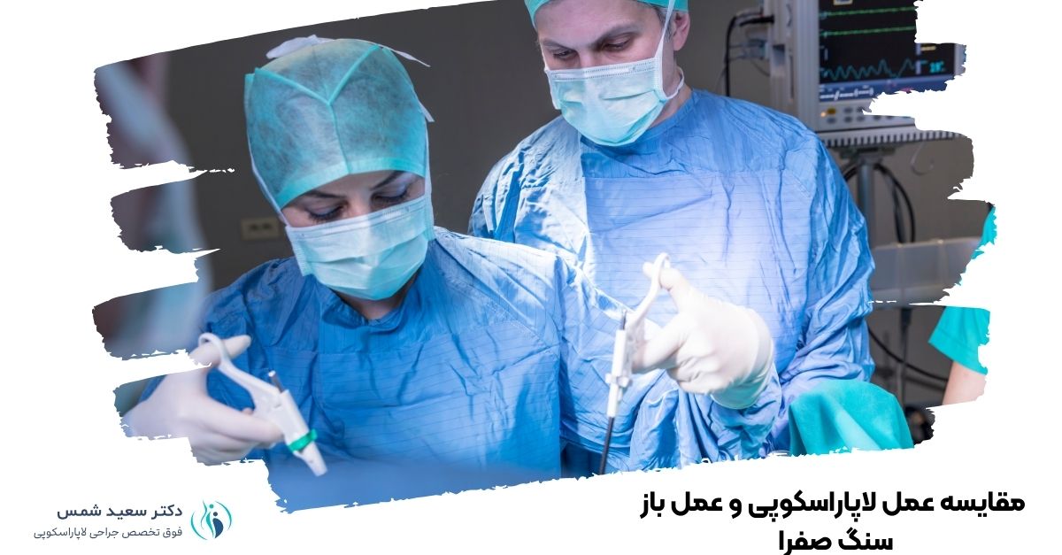 مقایسه عمل لاپاراسکوپی و عمل باز سنگ صفرا 