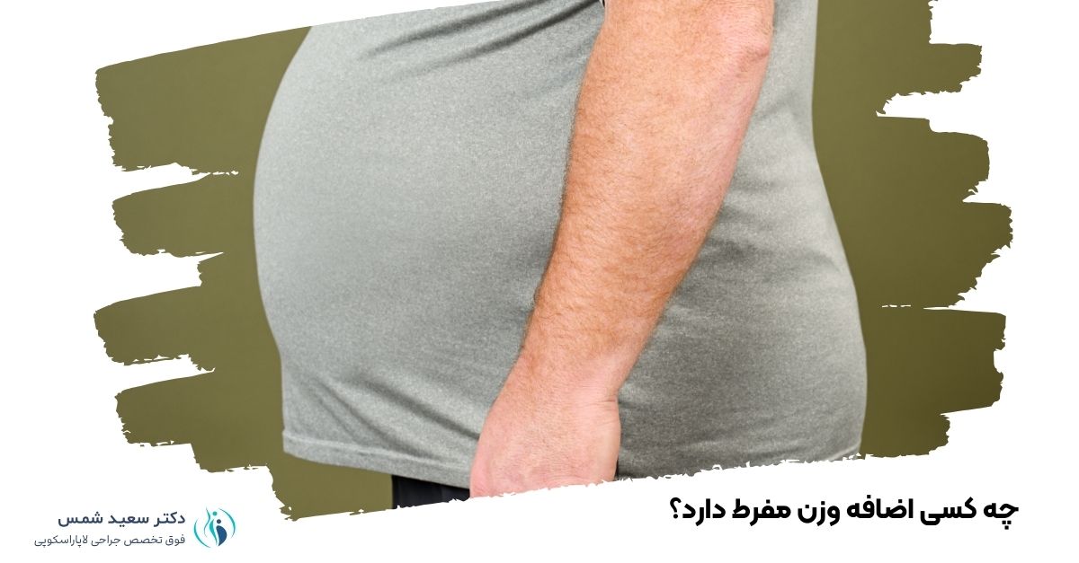 چاقی شدید چیست و چه کسی اضافه وزن مفرط دارد؟