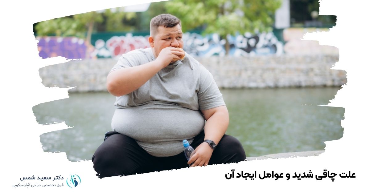 علت چاقی شدید و عوامل ایجاد ان 
