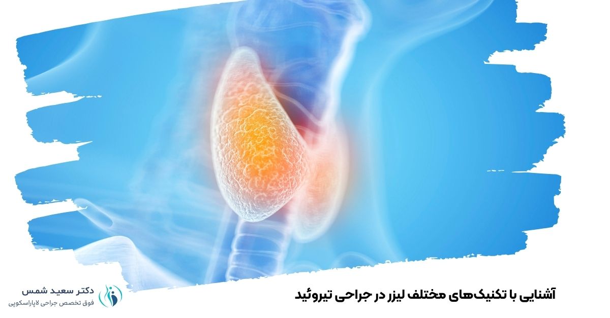 آشنایی با تکنیک‌های مختلف لیزر در جراحی تیروئید