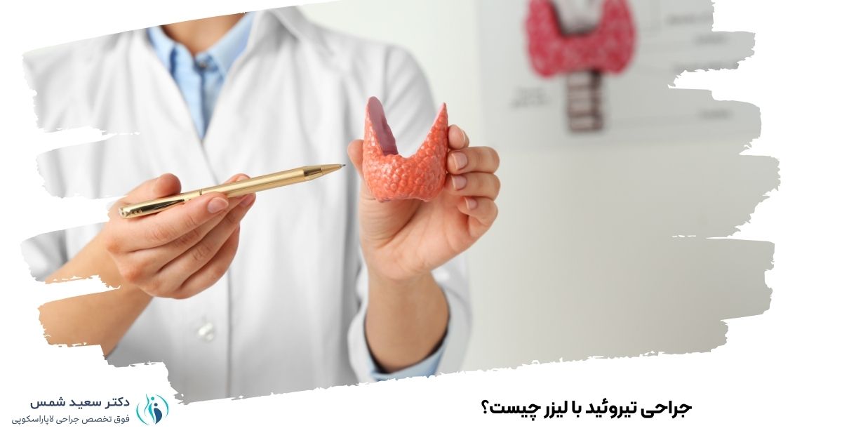 جراحی تیروئید با لیزر چیست؟