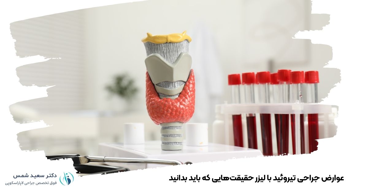 عوارض جراحی تیروئید با لیزر حقیقت‌هایی که باید بدانید