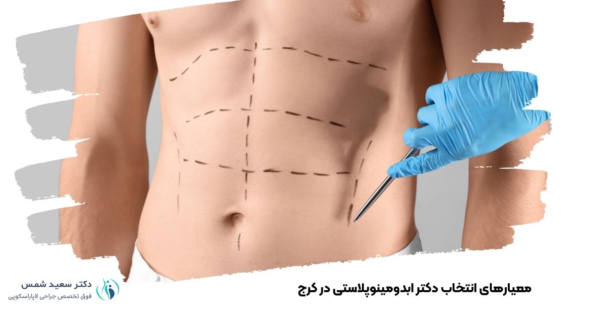 معیارهای انتخاب دکتر ابدومینوپلاستی در کرج