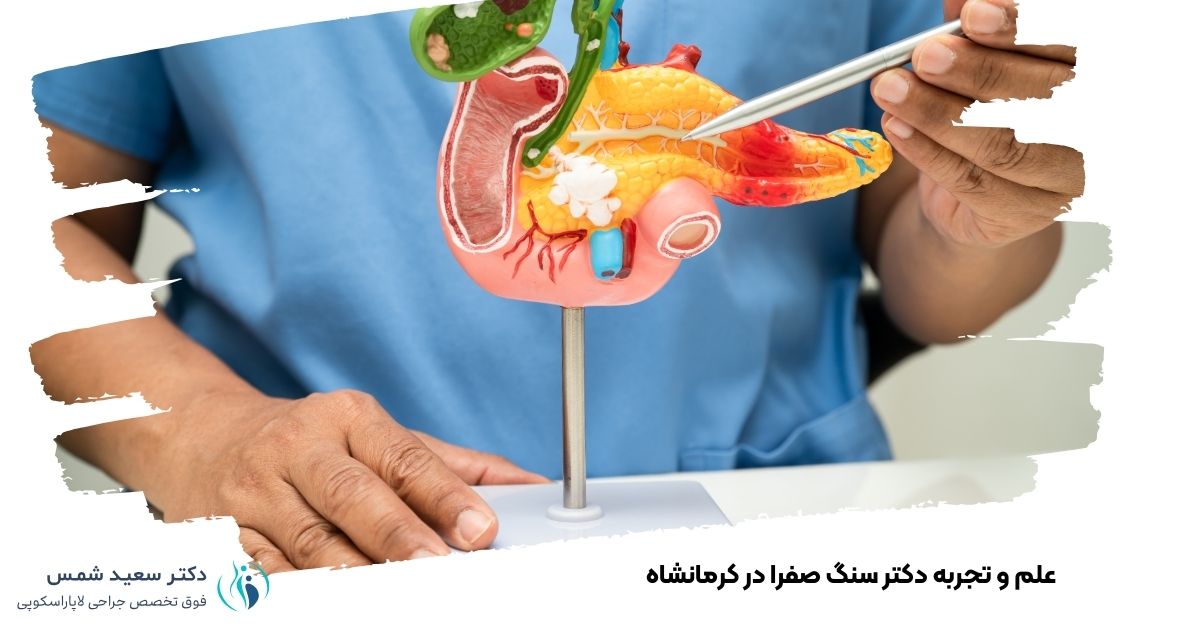 علم و تجربه دکتر سنگ صفرا در کرمانشاه
