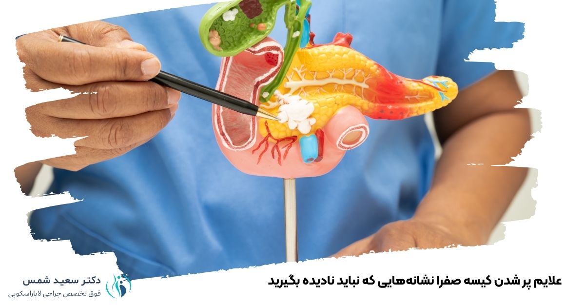 علایم پر شدن کیسه صفرا نشانه‌هایی که نباید نادیده بگیرید