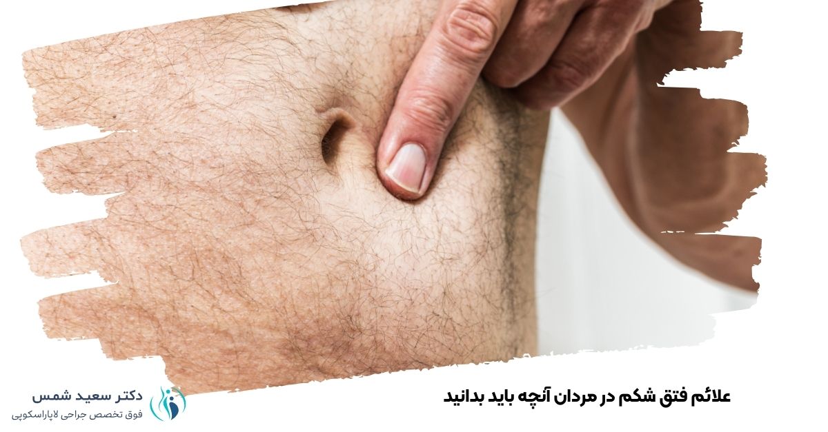 علائم فتق شکم در مردان آنچه باید بدانید