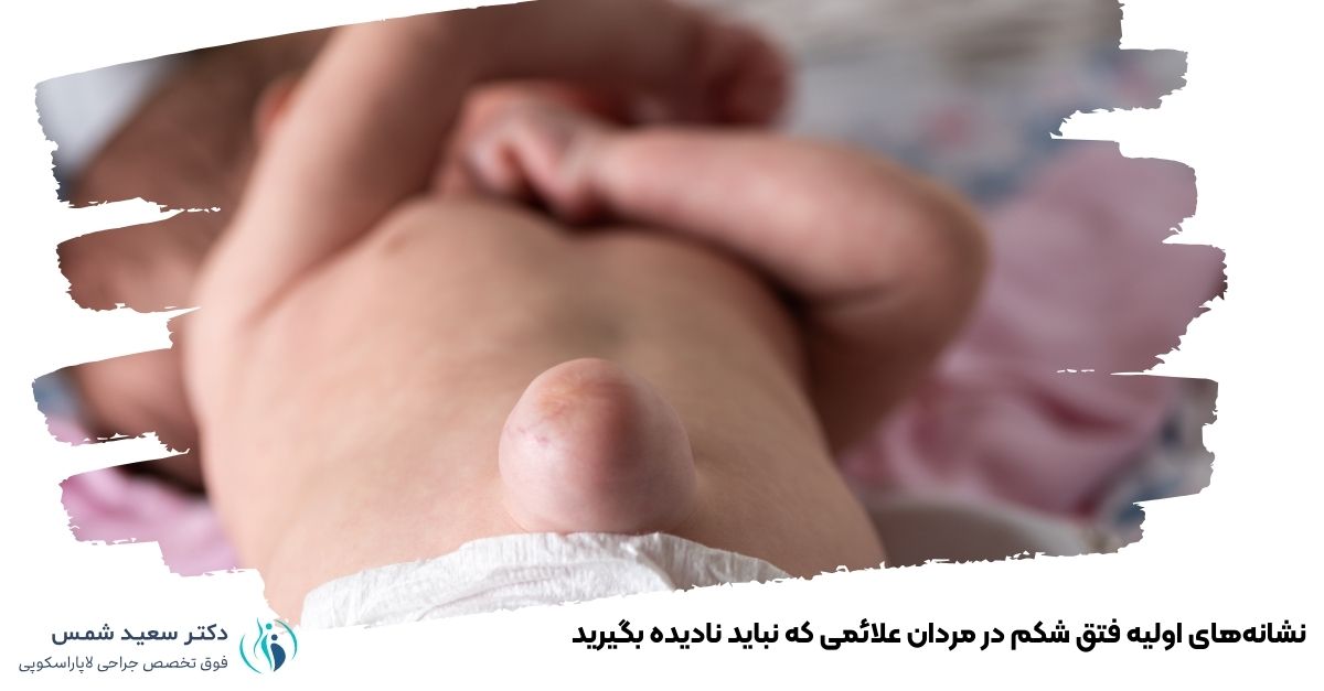 نشانه‌های اولیه فتق شکم در مردان علائمی که نباید نادیده بگیرید