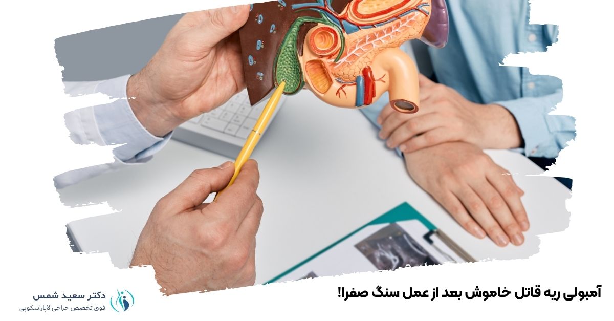 آمبولی ریه قاتل خاموش بعد از عمل سنگ صفرا!
