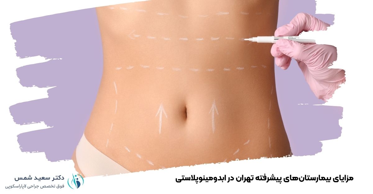 مزایای بیمارستانهای پیشرفته تهران در ابدومینوپلاستی