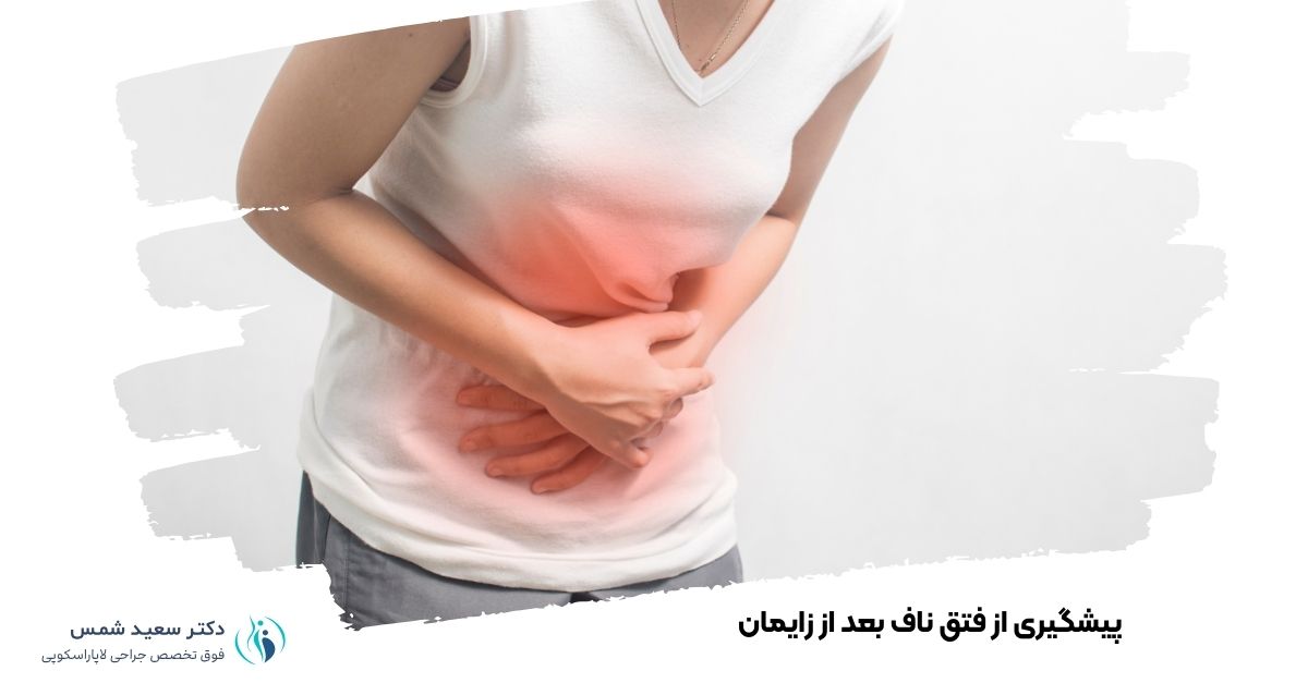پیشگیری از فتق ناف بعد از زایمان