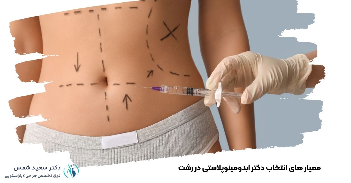 معیار های انتخاب دکتر ابدومینوپلاستی در رشت 