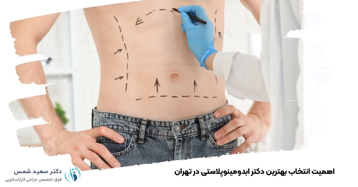 اهمیت انتخاب بهترین دکتر ابدومینوپلاستی در تهران