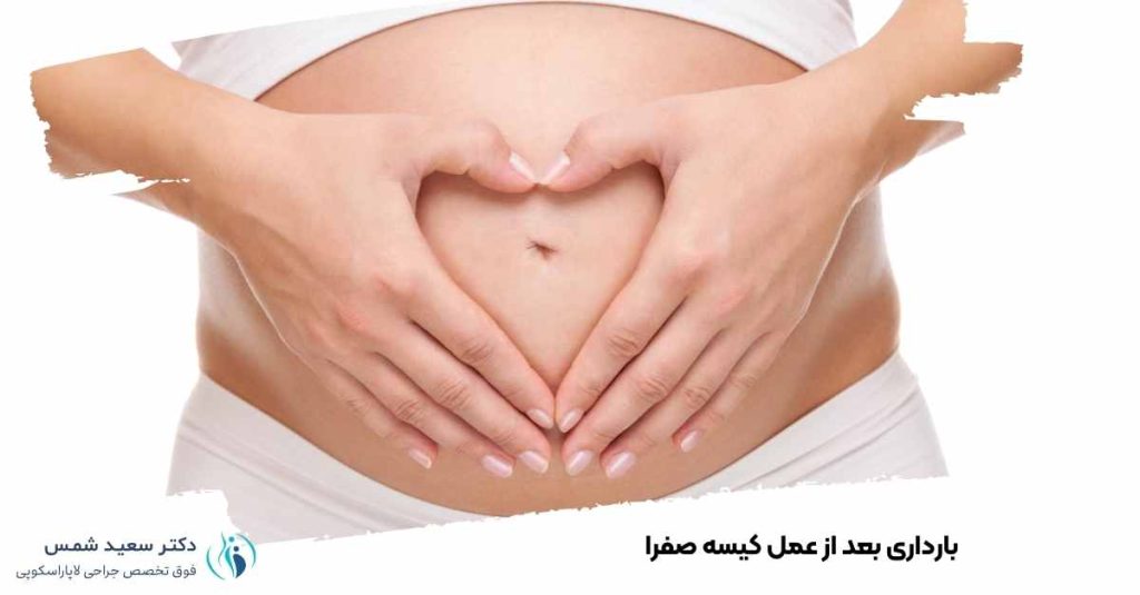 بارداری بعد از عمل کیسه صفرا