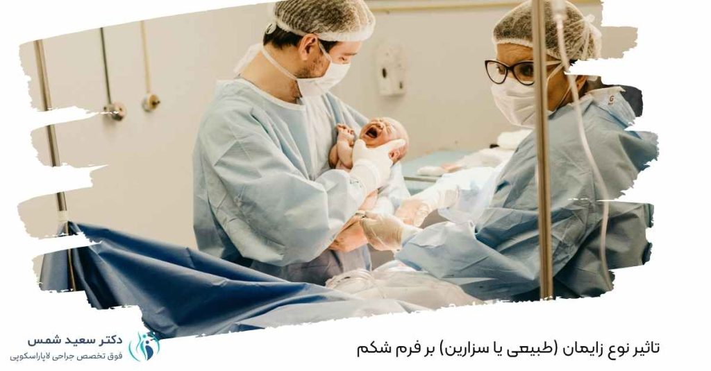تاثیر نوع زایمان بر فرم شکم