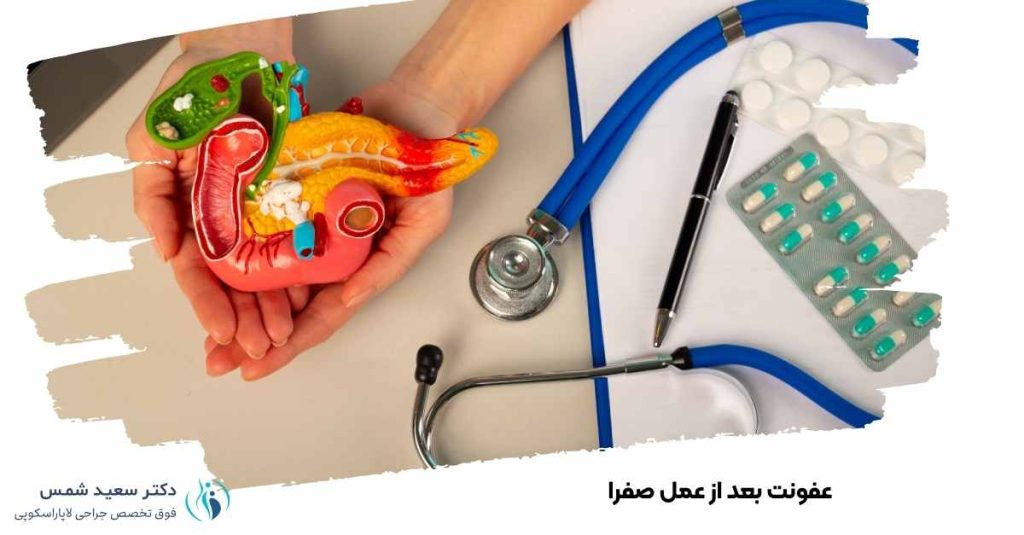 عفونت بعد عمل صفرا