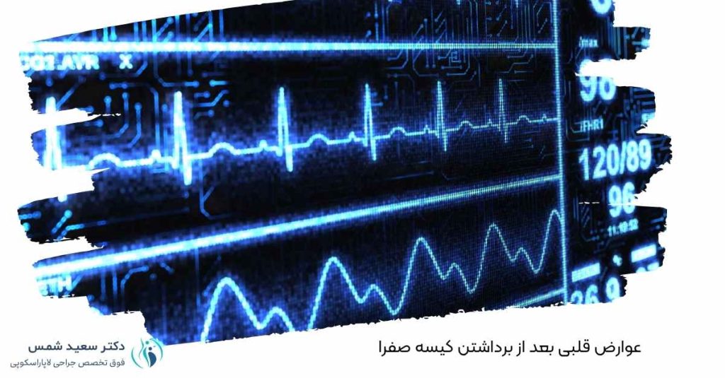 عوارض قلبی بعد از برداشتن کیسه صفرا