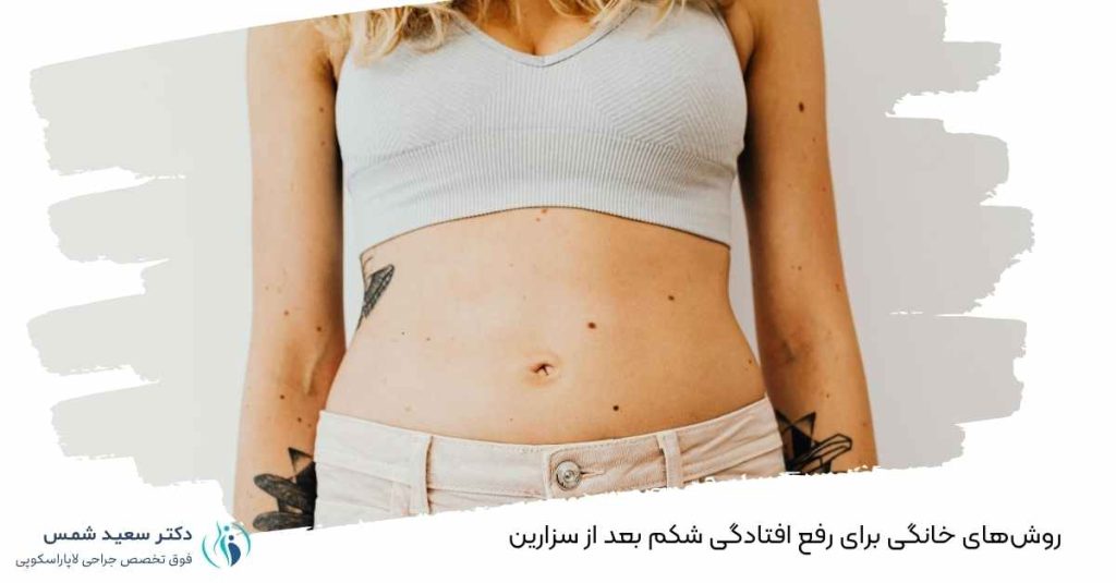 روش‌های خانگی برای رفع افتادگی شکم بعد از سزارین