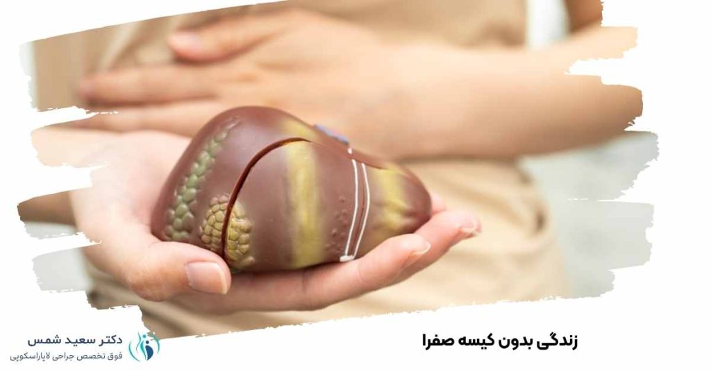 زندگی بدون کیسه صفرا
