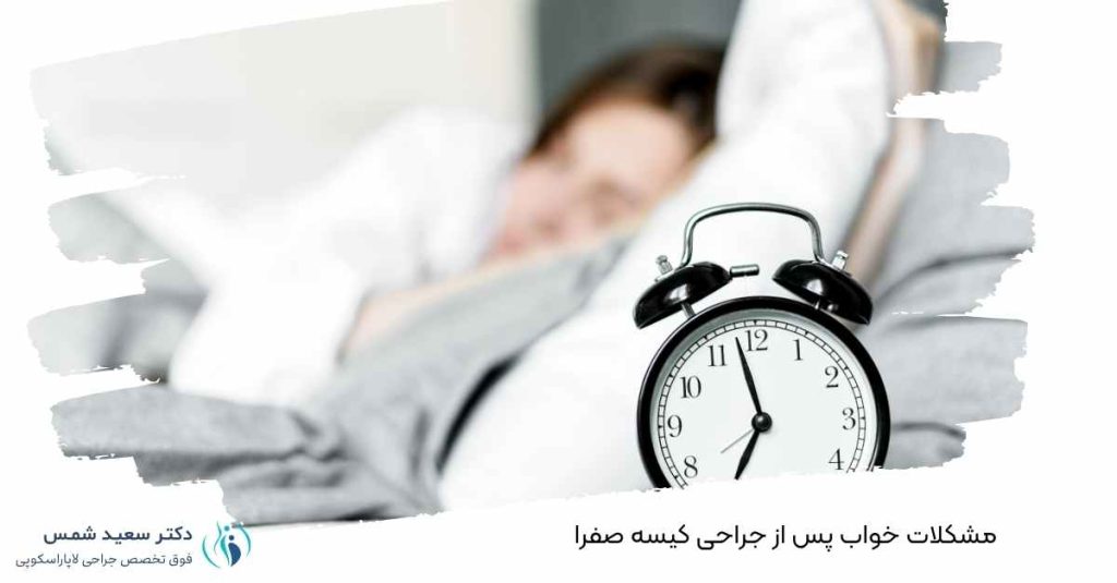 مشکلات خواب پس از جراحی کیسه صفرا