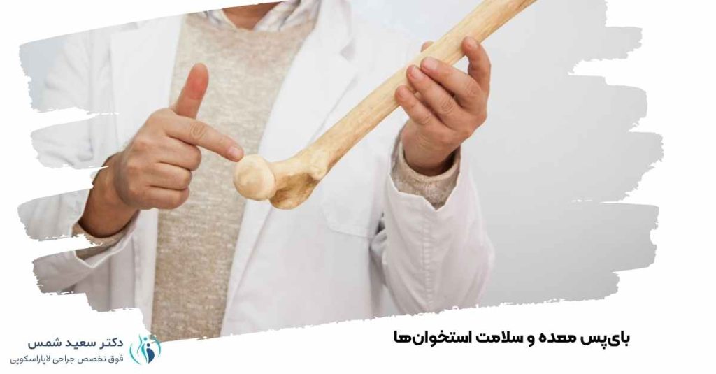 بای‌پس معده و سلامت استخوان‌ها