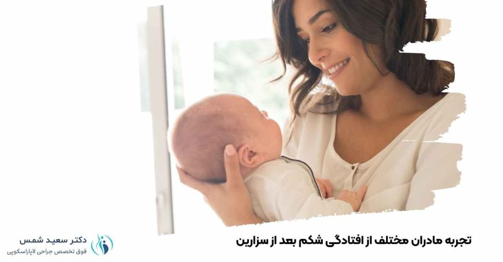 تجربه مادران مختلف از افتادگی شکم بعد از سزارین