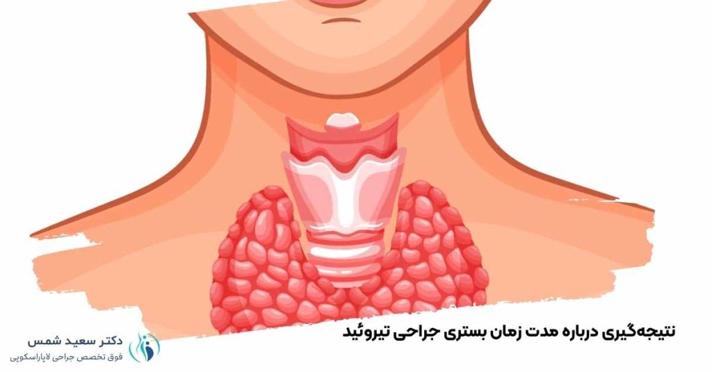 نتیجه‌گیری مدت زمان بستری جراحی تیروئید