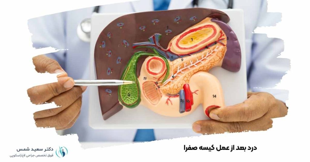 درد بعد از عمل کیسه صفرا