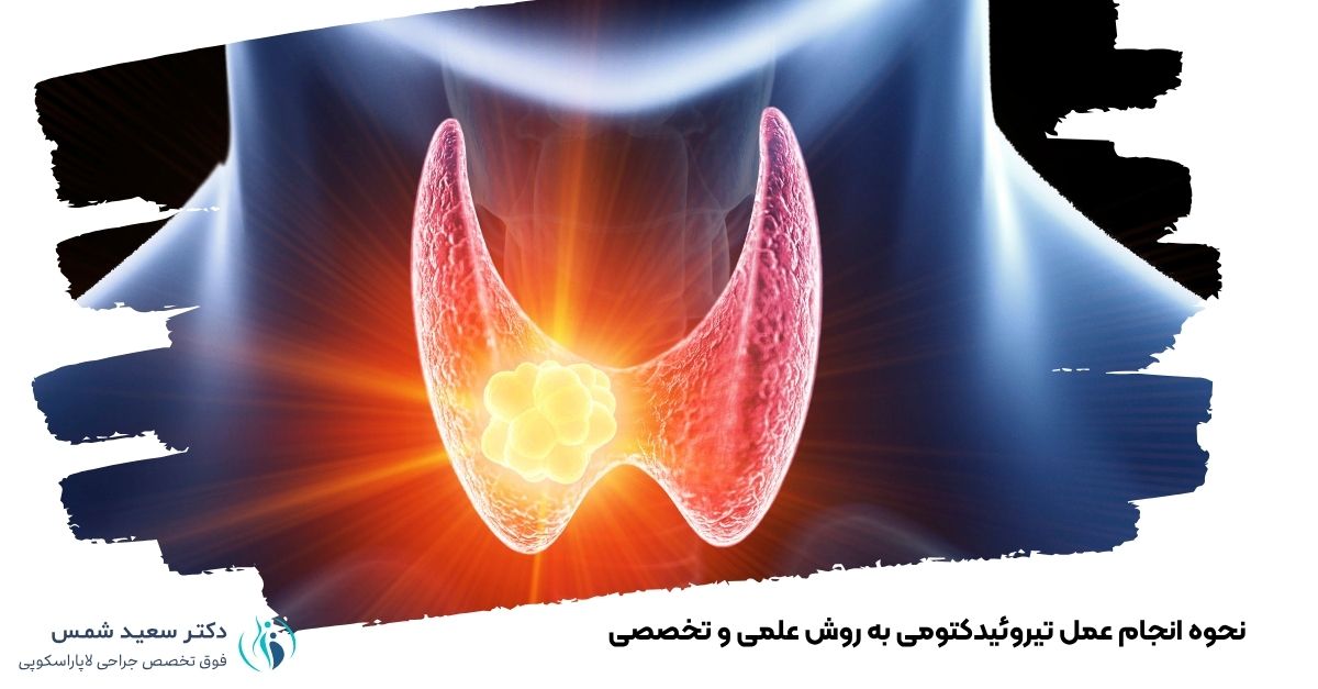 نحوه انجام عمل تیروئیدکتومی به روش علمی و تخصصی