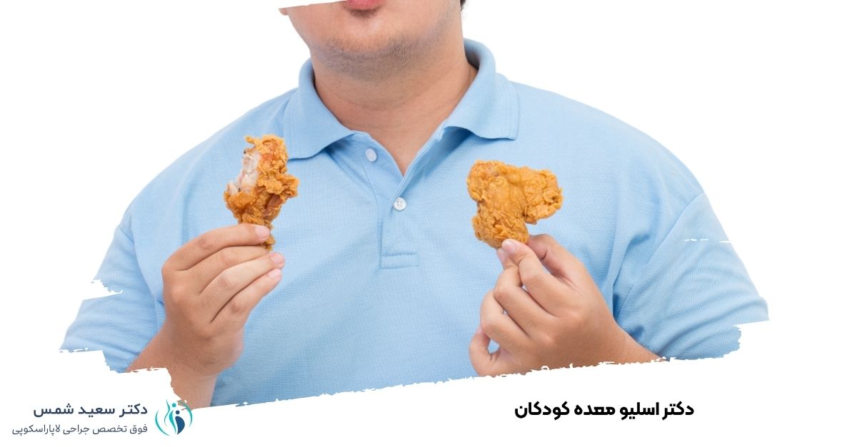 اسلیو معده کودکان