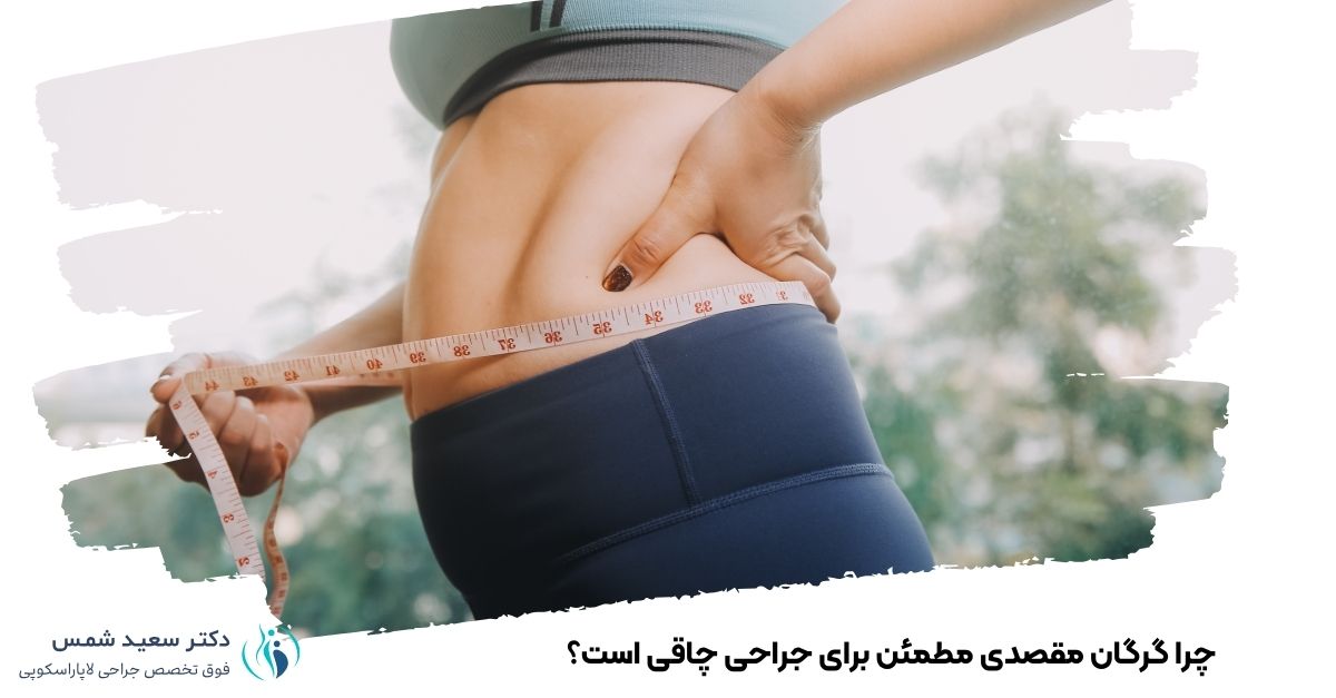 چرا گرگان مقصدی مطمئن برای جراحی چاقی است؟