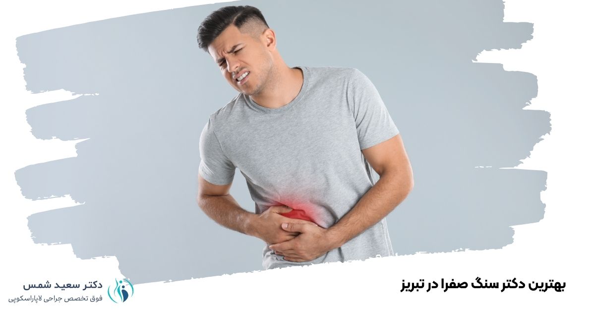 بهترین دکتر سنگ صفرا در تبریز