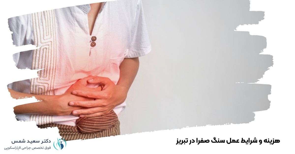 هزینه و شرایط عمل سنگ صفرا در تبریز