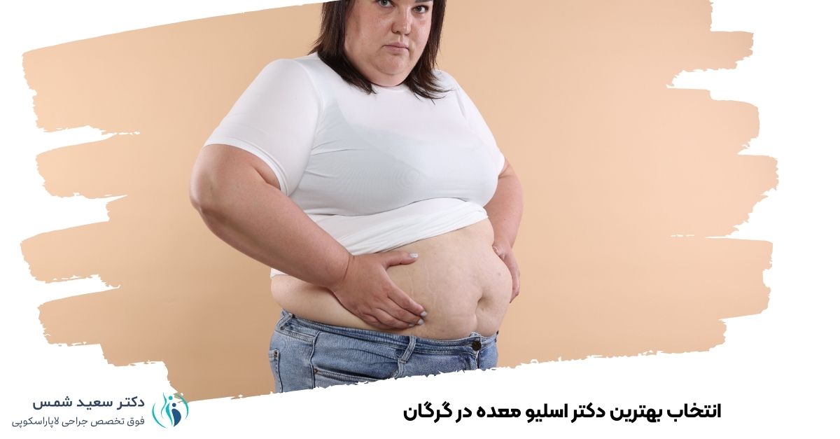 انتخاب بهترین دکتر اسلیو معده در گرگان