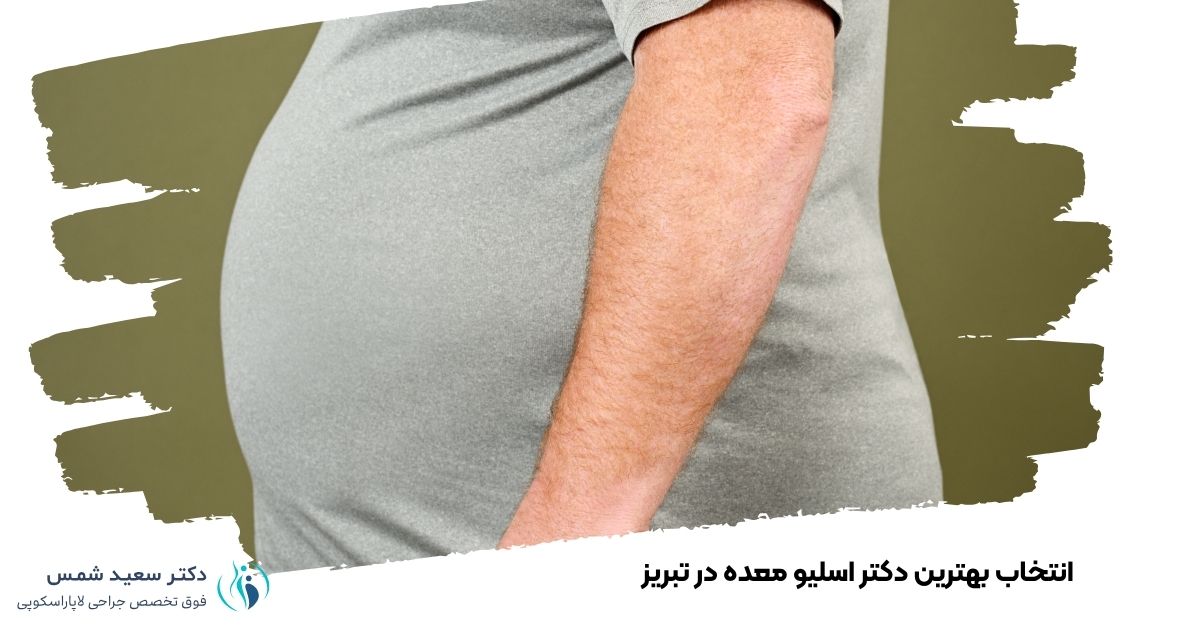 انتخاب بهترین دکتر اسلیو معده در تبریز