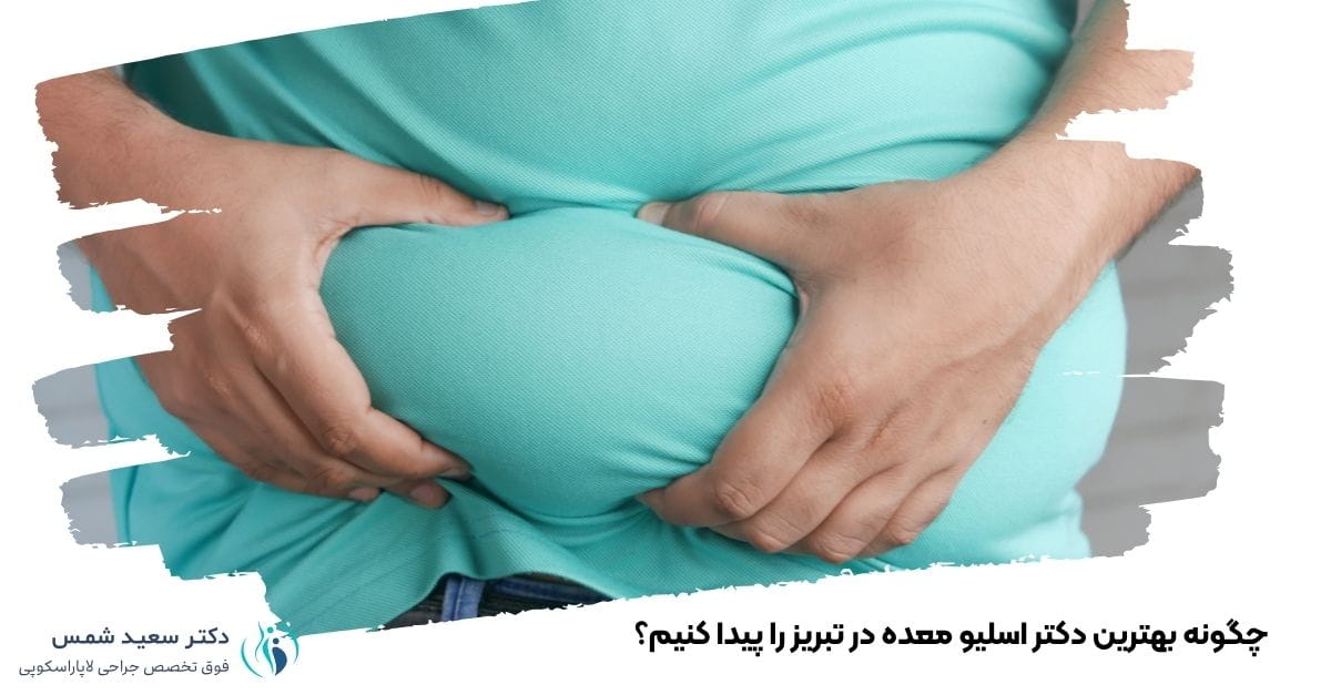 چگونه بهترین دکتر اسلیو معده در تبریز را پیدا کنیم؟