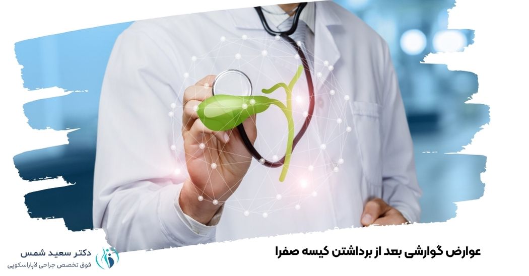 رژیم غذایی بعد از برداشتن کیسه صفرا