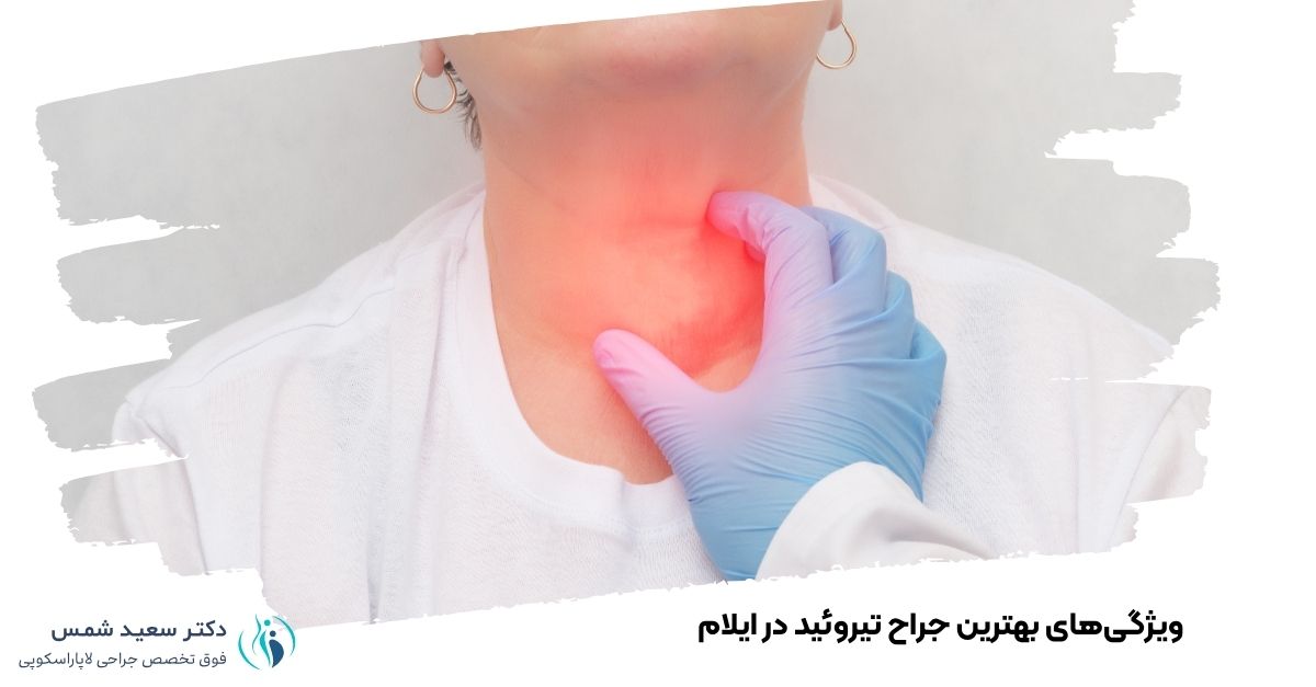 ویژگیهای بهترین جراح تیروئید در ایلام