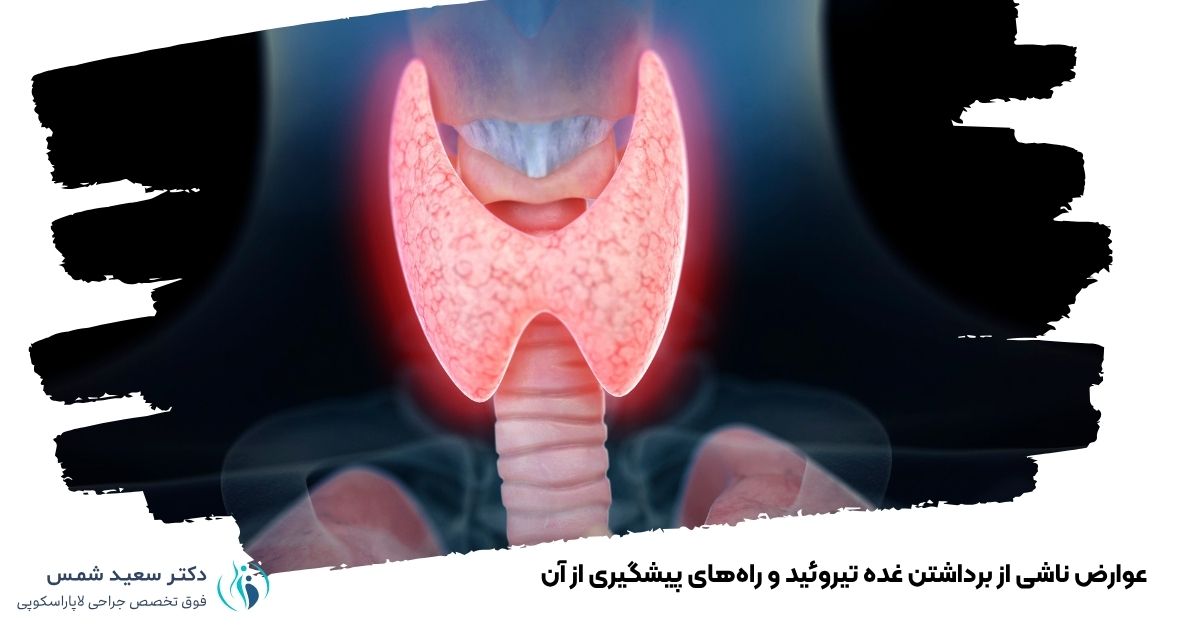 عوارض ناشی از برداشتن غده تیروئید و راههای پیشگیری از آن