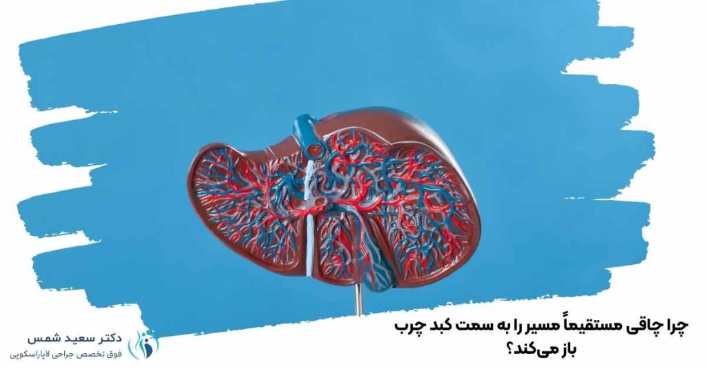 چاقی مستقیماً مسیر را به سمت کبد چرب باز میکند؟