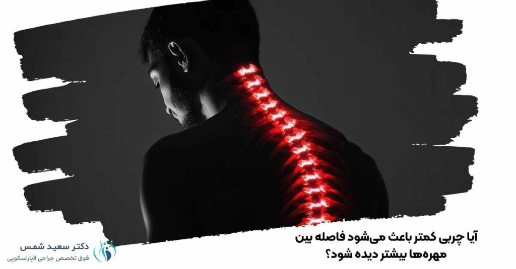 چربی کمتر و فاصله بین مهرهها