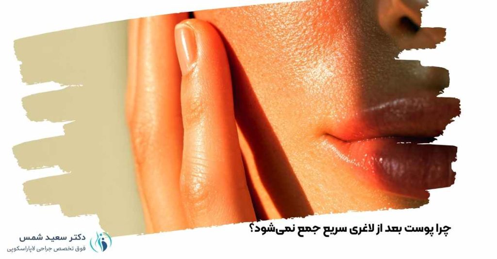 چرا پوست بعد از لاغری سریع جمع نمیشود؟