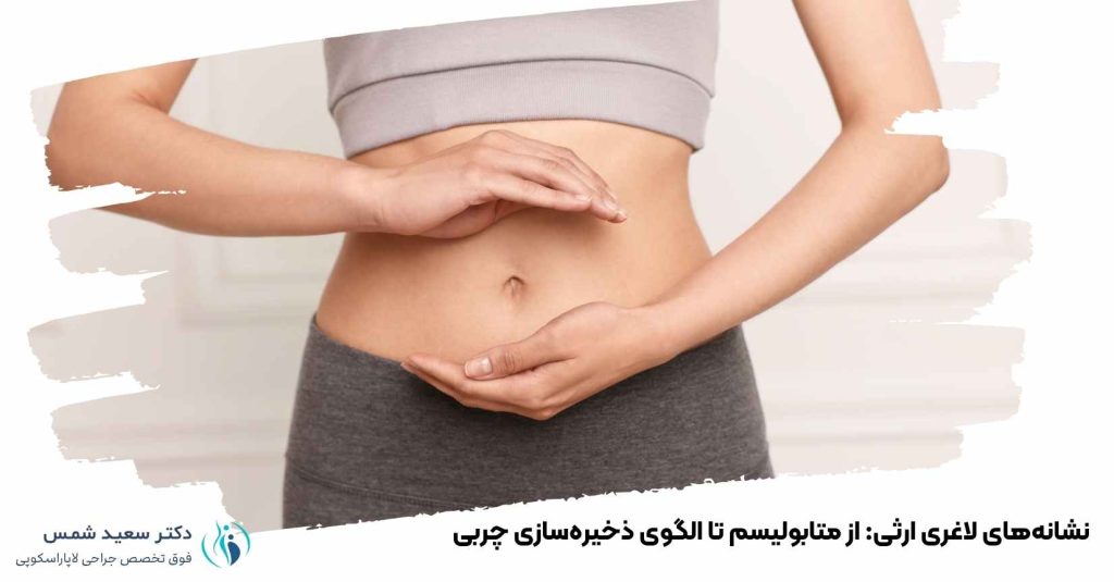 لاغری ارثی