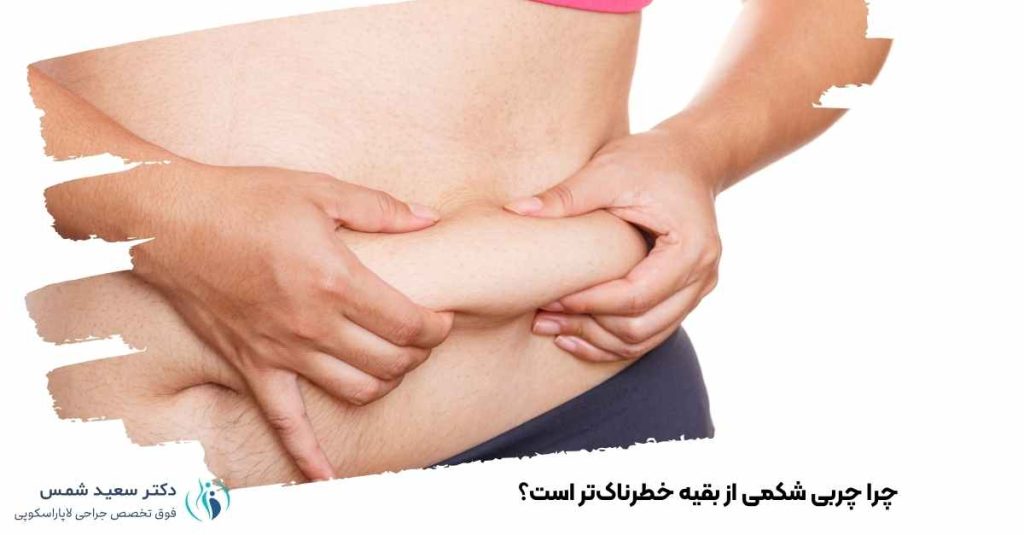 چربی شکمی از بقیه خطرناکتر است؟