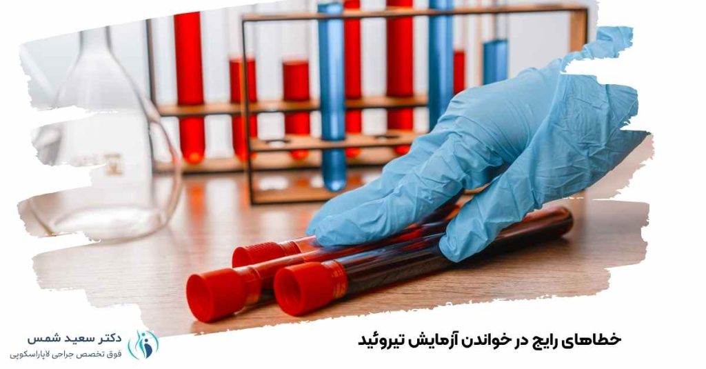 خطاهای رایج خواندن آزمایش تیروئید