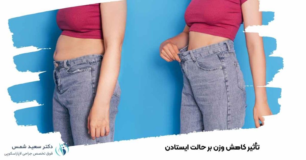 تأثیر کاهش وزن بر حالت ایستادن