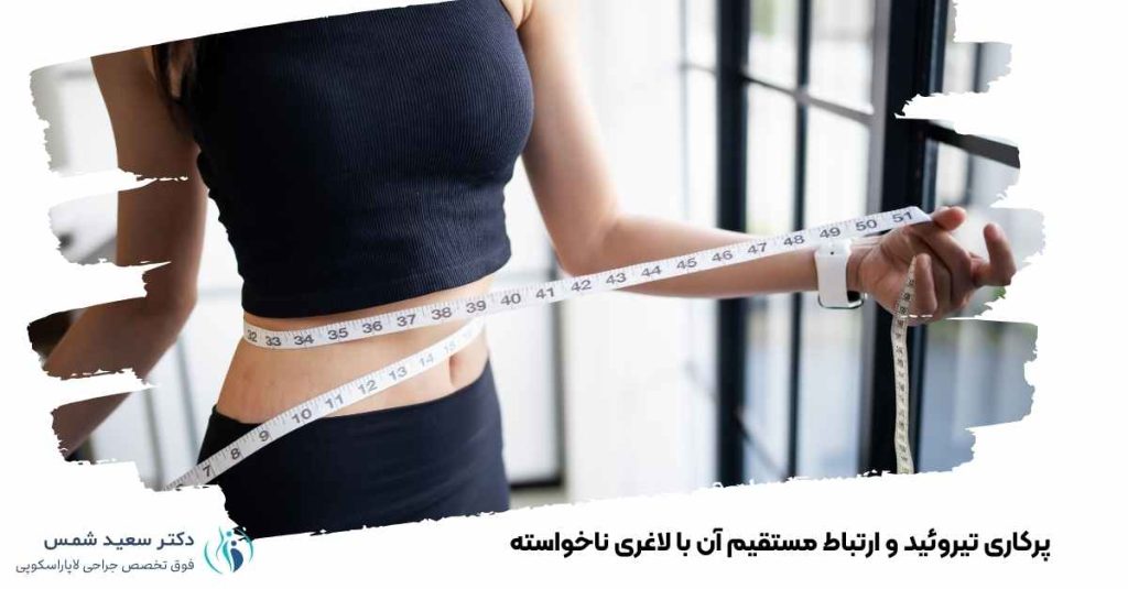 پرکاری تیروئید و ارتباط آن با لاغری