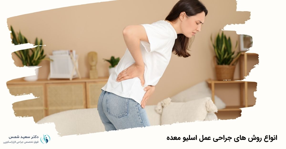 انواع روش های جراحی عمل اسلیو معده