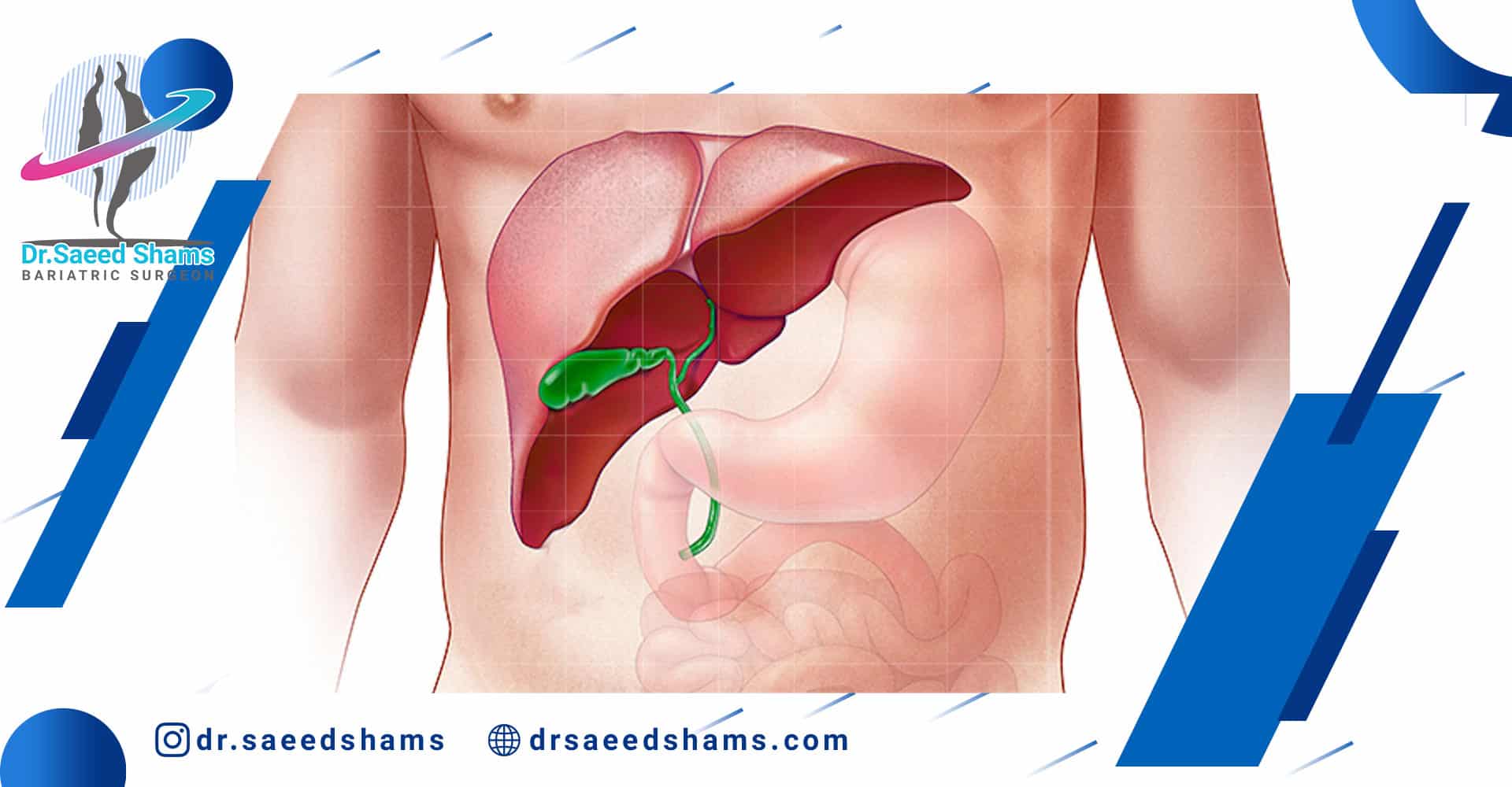 عمل کیسه صفرا خطر ناک است