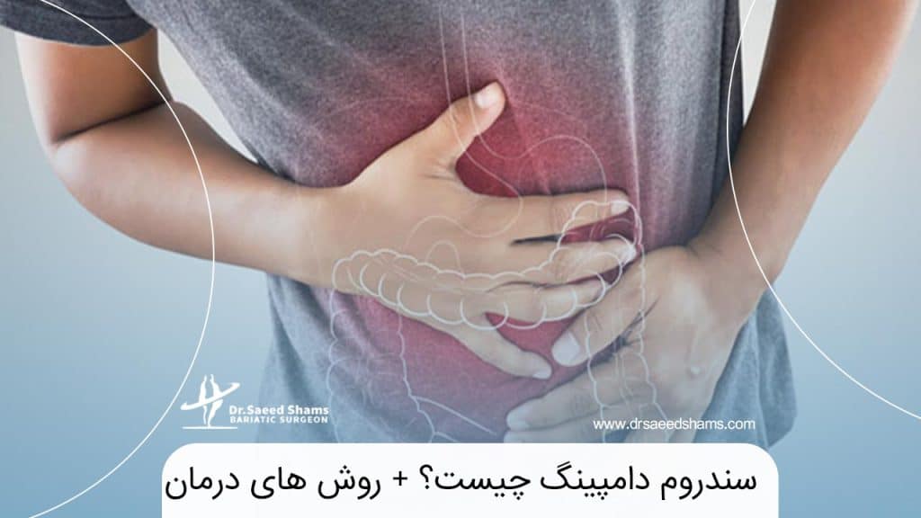 سندروم دامپینگ
