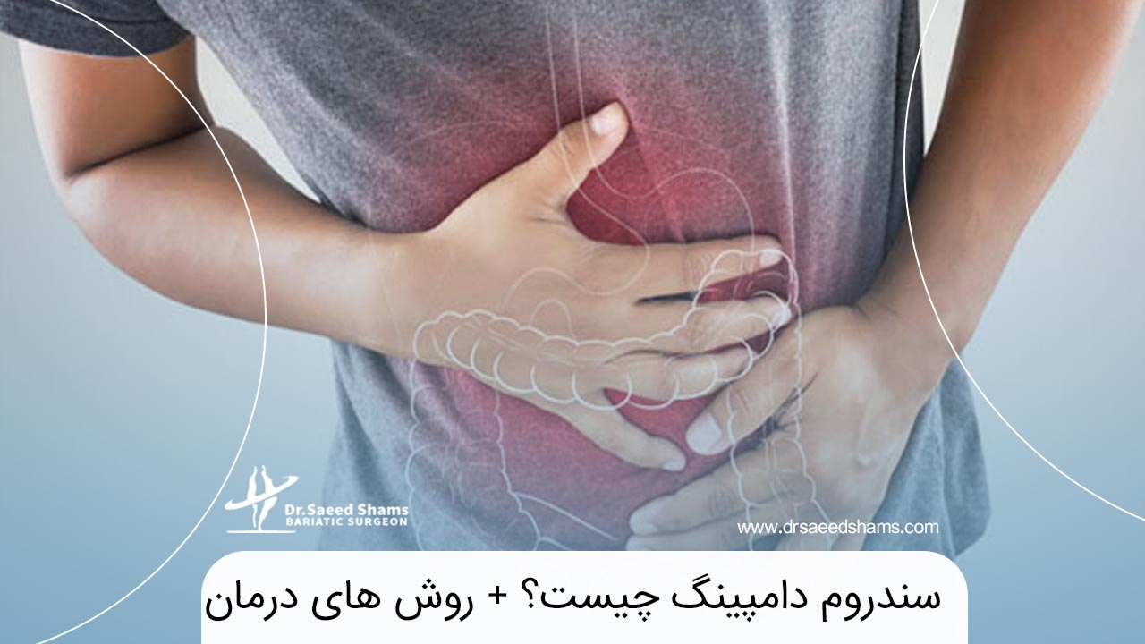 سندروم دامپینگ